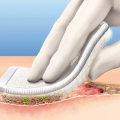 The Best Wound Care Supplies For Managing Slough Wound Tissue