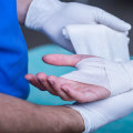 The Importance of a Wound Care Specialist