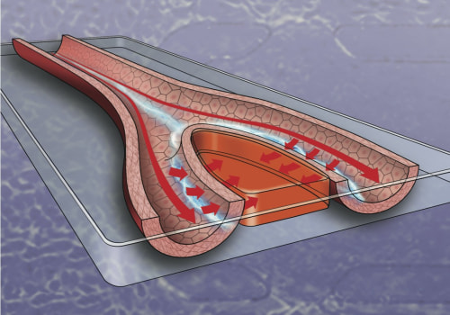 The Revolutionary Role of Platelet-Rich Plasma in Wound Healing