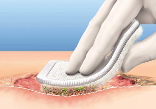 The Best Wound Care Supplies For Managing Slough Wound Tissue