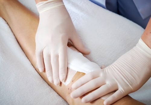 What Is Granulation Tissue? Tips For Choosing the Right Wound Care Supplies