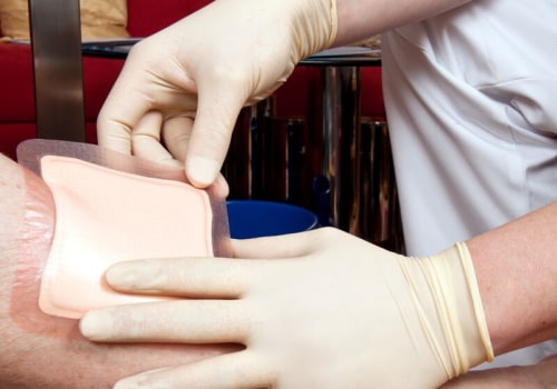 The Comprehensive Approach to Wound Care Management: A Guide from an Expert's Perspective